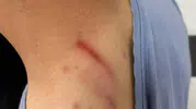 Diyarbakırda hastanede doktoru bulamayan hasta tıbbi sekretere saldırdı