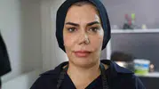 Elazığlı kadının burnu dört ameliyat sonrası tanınmaz hale geldi