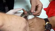 Bitlis’te lokantada oyun oynayan çocuğun parmağı çelik halkaya sıkıştı