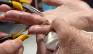 Batman'da parmağına yüzük sıkışan yaşlı adam hastanede rahat bir nefes aldı