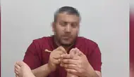 Şanlıurfa'da sahte doktor operasyonu İnşaat ustası hasta tedavi ediyordu