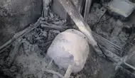 Nusaybin ilçesinde mutfak tüpü yangını ev sakinlerini hastanelik etti