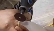 Van'da kaza sonrası parmağı şişen kadına itfaiye yardımı