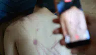 Elazığda özel eğitim merkezinde korkunç şiddet iddiası