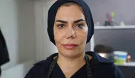 Elazığlı kadının burnu dört ameliyat sonrası tanınmaz hale geldi