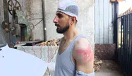 Şanlıurfa’da yol verme kavgasında sürücüyü araçtan indirip darbettiler