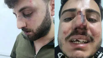 Van Başkale’de ‘polis darp’ iddiası: 3 kardeş hastanelik, soruşturma başlatıldı