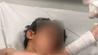 Şırnak'ta talihsiz kaza: 3 yaşındaki çocuğun üzerine kaynar su döküldü
