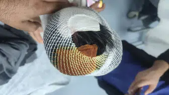 Viranşehirde okul yolunda köpek saldırısı dehşeti