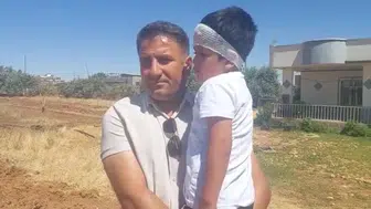 Şanlıurfa’da köpek saldırısına uğrayan 8 yaşındaki çocuk hastanelik oldu