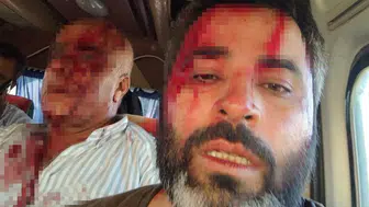 Şanlıurfa Akçakale’de arazi kavgası kanlı bitti