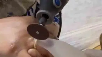 Van'da kaza sonrası parmağı şişen kadına itfaiye yardımı