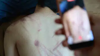 Elazığda özel eğitim merkezinde korkunç şiddet iddiası