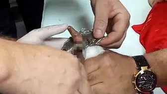 Bitlis’te lokantada oyun oynayan çocuğun parmağı çelik halkaya sıkıştı