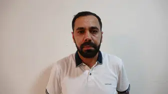 Estetik ameliyat sonrası burnunda oluşan iz için hastaneye dava açtı