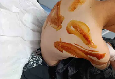 Şanlıurfa Eyyübiye'de 17 yaşındaki genç komşusu olan çocuğu sopayla ağır yaraladı