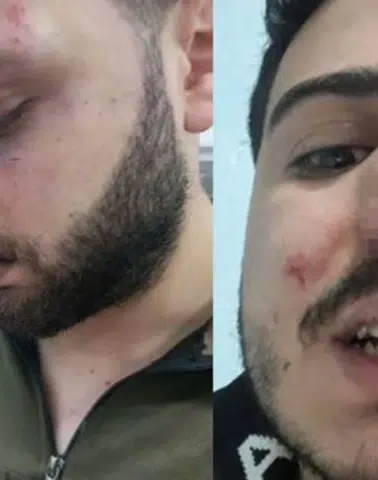 Van Başkale’de ‘polis darp’ iddiası: 3 kardeş hastanelik, soruşturma başlatıldı