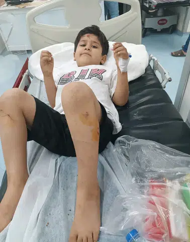 Viranşehirde 8 yaşındaki çocuğa sokak köpeği saldırısı