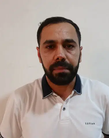 Estetik ameliyat sonrası burnunda oluşan iz için hastaneye dava açtı