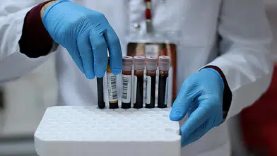Bilim insanları yeni bir kan grubu buldu