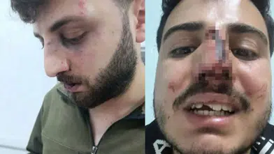 Van Başkale’de ‘polis darp’ iddiası: 3 kardeş hastanelik, soruşturma başlatıldı
