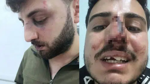 Van Başkale’de ‘polis darp’ iddiası: 3 kardeş hastanelik, soruşturma başlatıldı