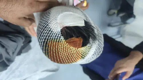 Viranşehirde okul yolunda köpek saldırısı dehşeti