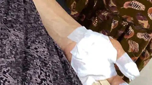 Silopi’de sokak köpekleri üç kadına saldırdı