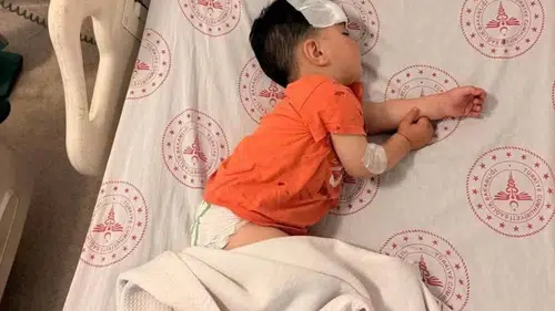 Halfeti'de oyun oynayan küçük çocuk köpek saldırısı sonucu yaralandı
