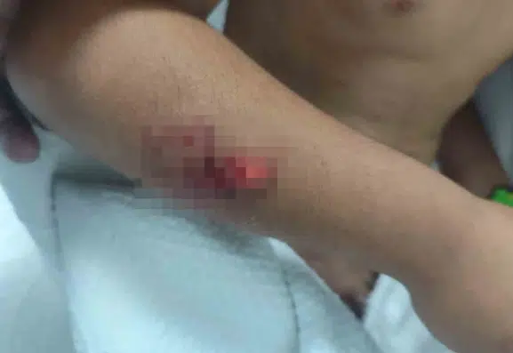 Viranşehirde okul çıkışı köpek saldırısına uğrayan öğrenci hastanelik oldu