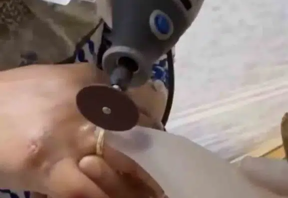 Van'da kaza sonrası parmağı şişen kadına itfaiye yardımı