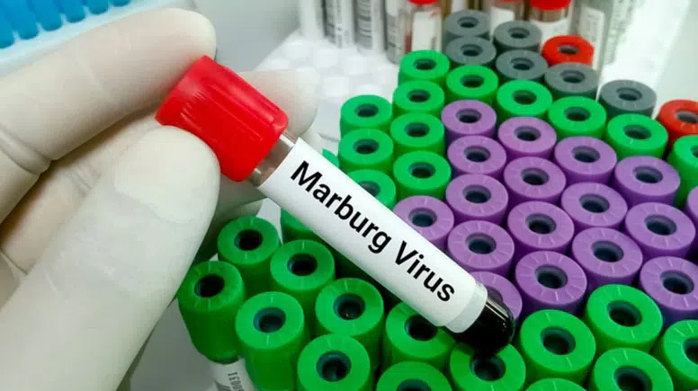 Marburg virüsü paniği: Marburg virüsü nedir, belirtileri nelerdir?