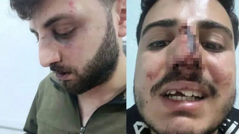 Van Başkale’de ‘polis darp’ iddiası: 3 kardeş hastanelik, soruşturma başlatıldı