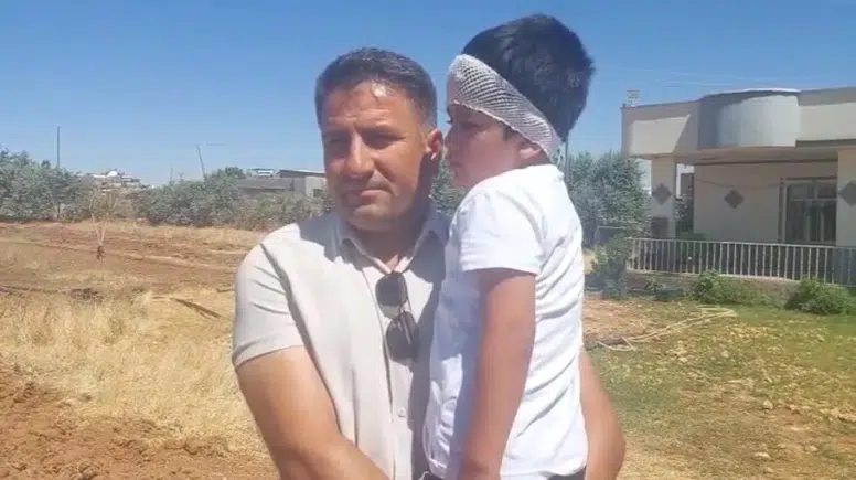 Şanlıurfa’da köpek saldırısına uğrayan 8 yaşındaki çocuk hastanelik oldu
