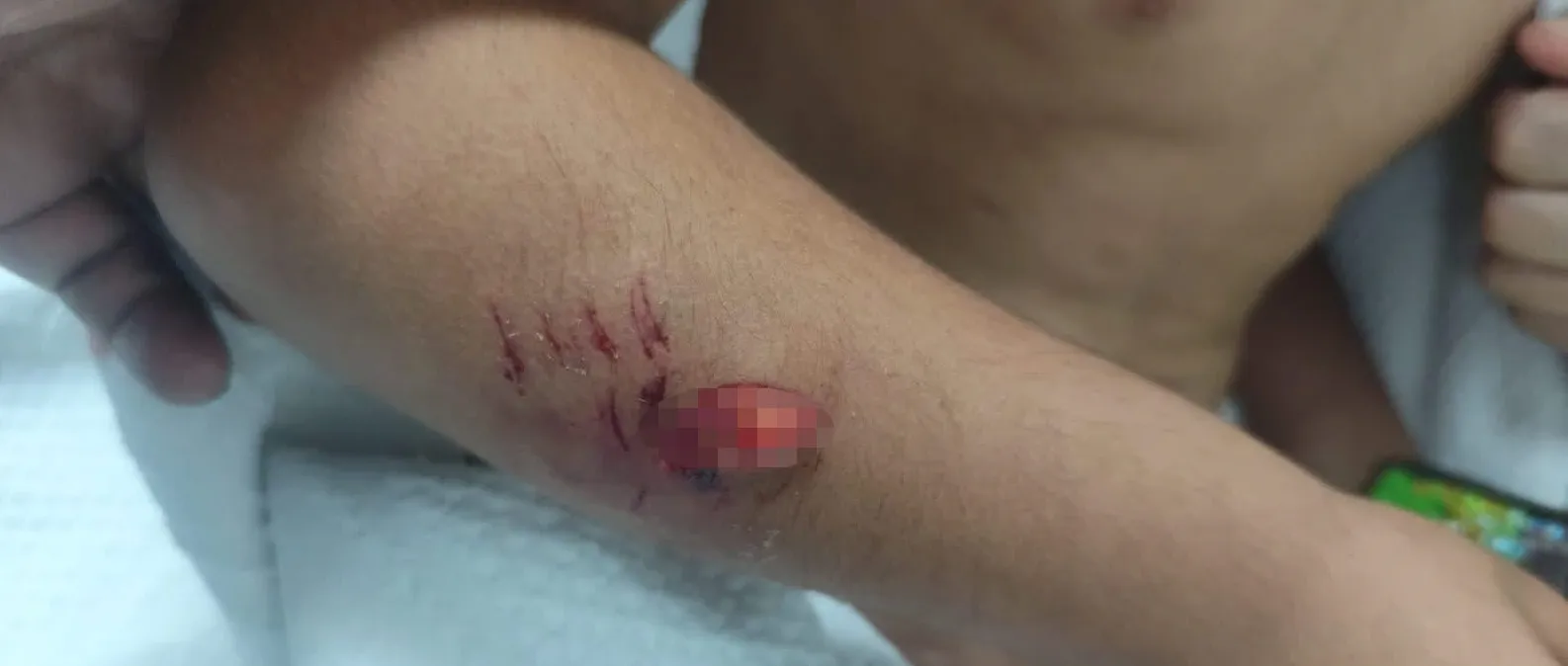 Viranşehirde okul yolunda köpek saldırısı dehşeti