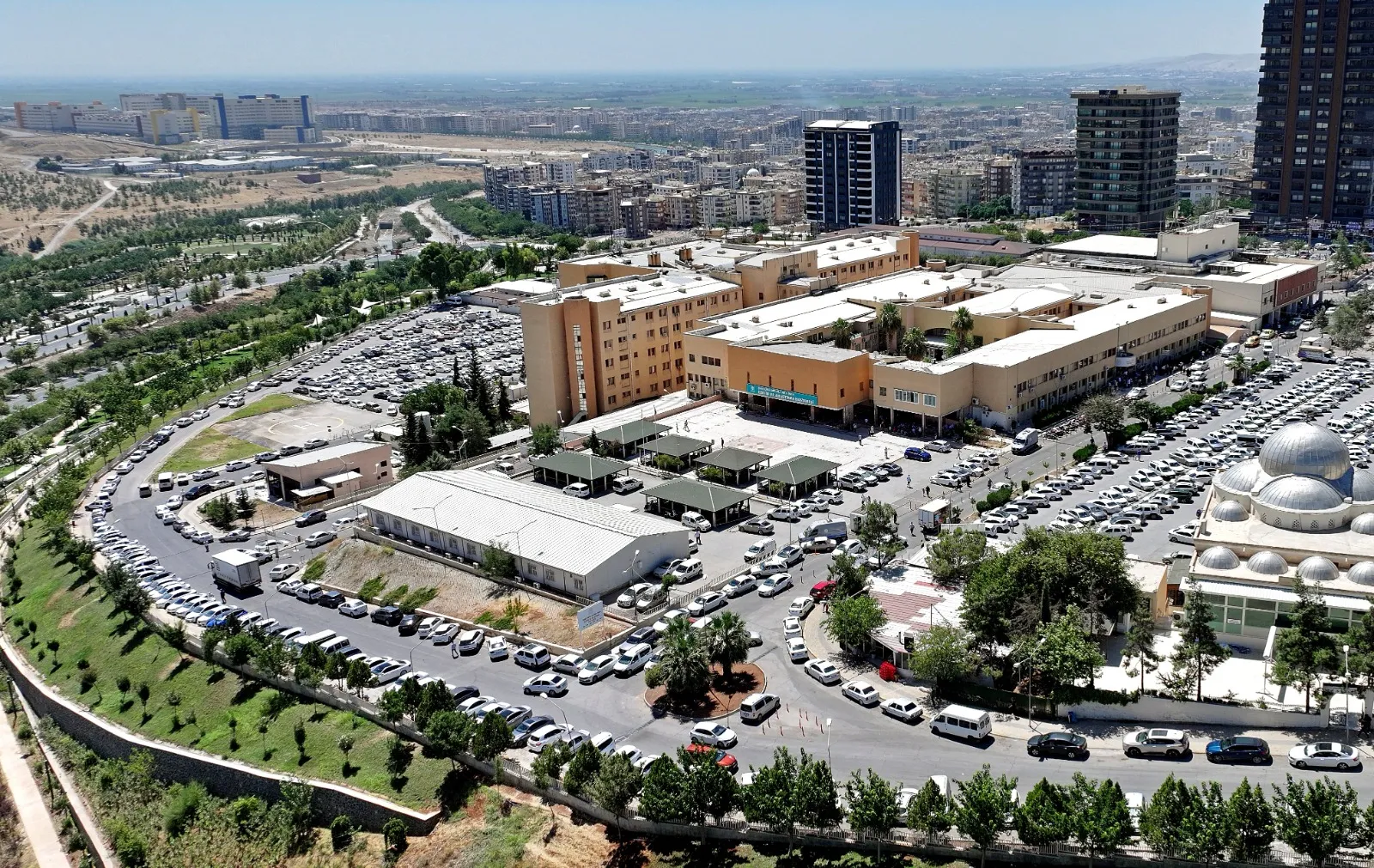 Şanlıurfa'da 60 yaşındaki hastanın beyninden 10 santimetrelik dev kitle çıkarıldı