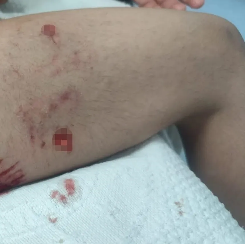 Viranşehirde okul yolunda köpek saldırısı dehşeti