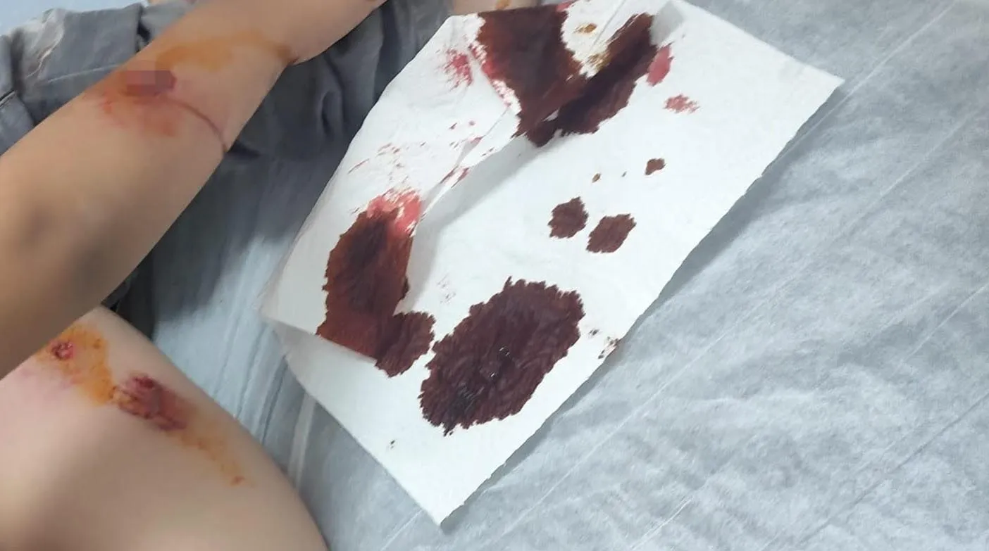 Viranşehirde okul yolunda köpek saldırısı dehşeti