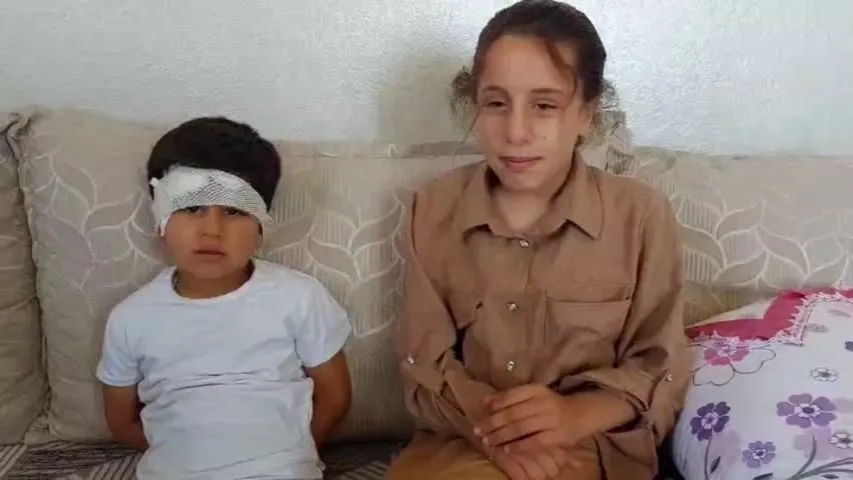 Şanlıurfa’da köpek saldırısına uğrayan 8 yaşındaki çocuk hastanelik oldu