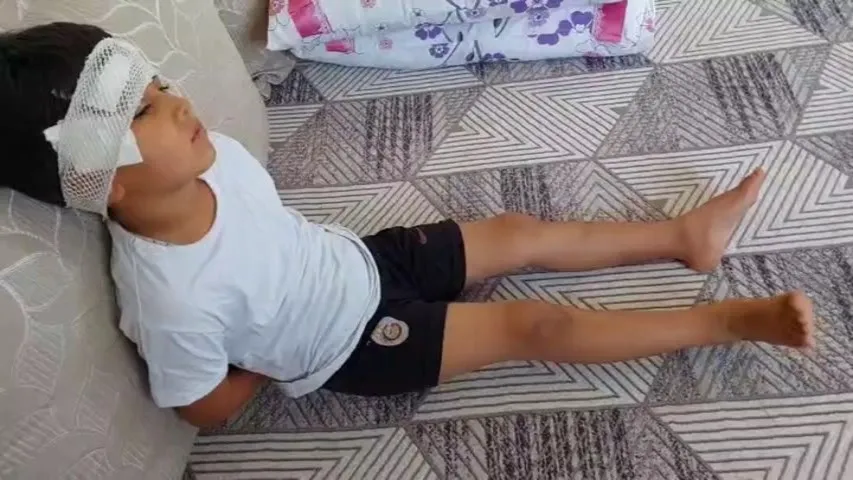 Şanlıurfa’da köpek saldırısına uğrayan 8 yaşındaki çocuk hastanelik oldu