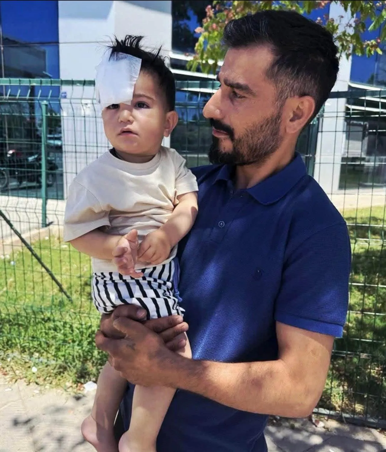 Halfeti'de oyun oynayan küçük çocuk köpek saldırısı sonucu yaralandı