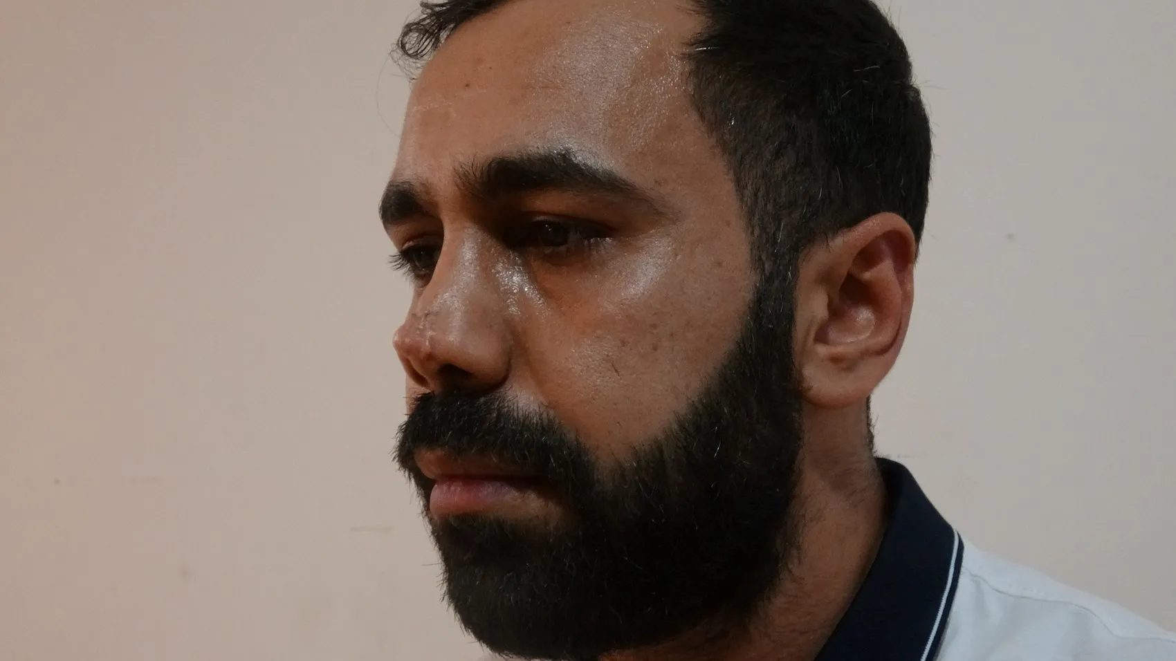 Estetik ameliyat sonrası burnunda oluşan iz için hastaneye dava açtı