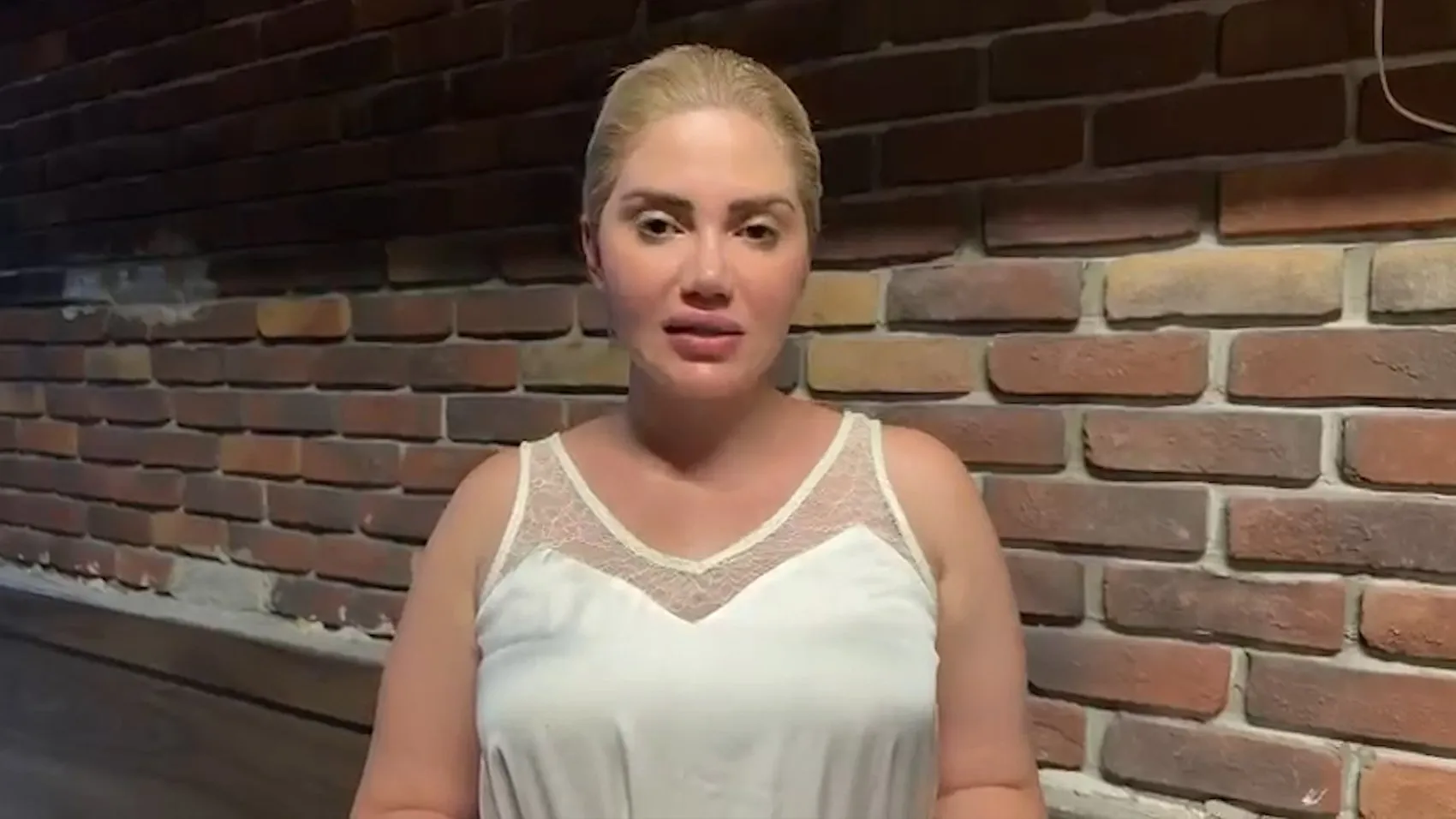 Estetik ameliyat sonrası burnunda oluşan iz için hastaneye dava açtı