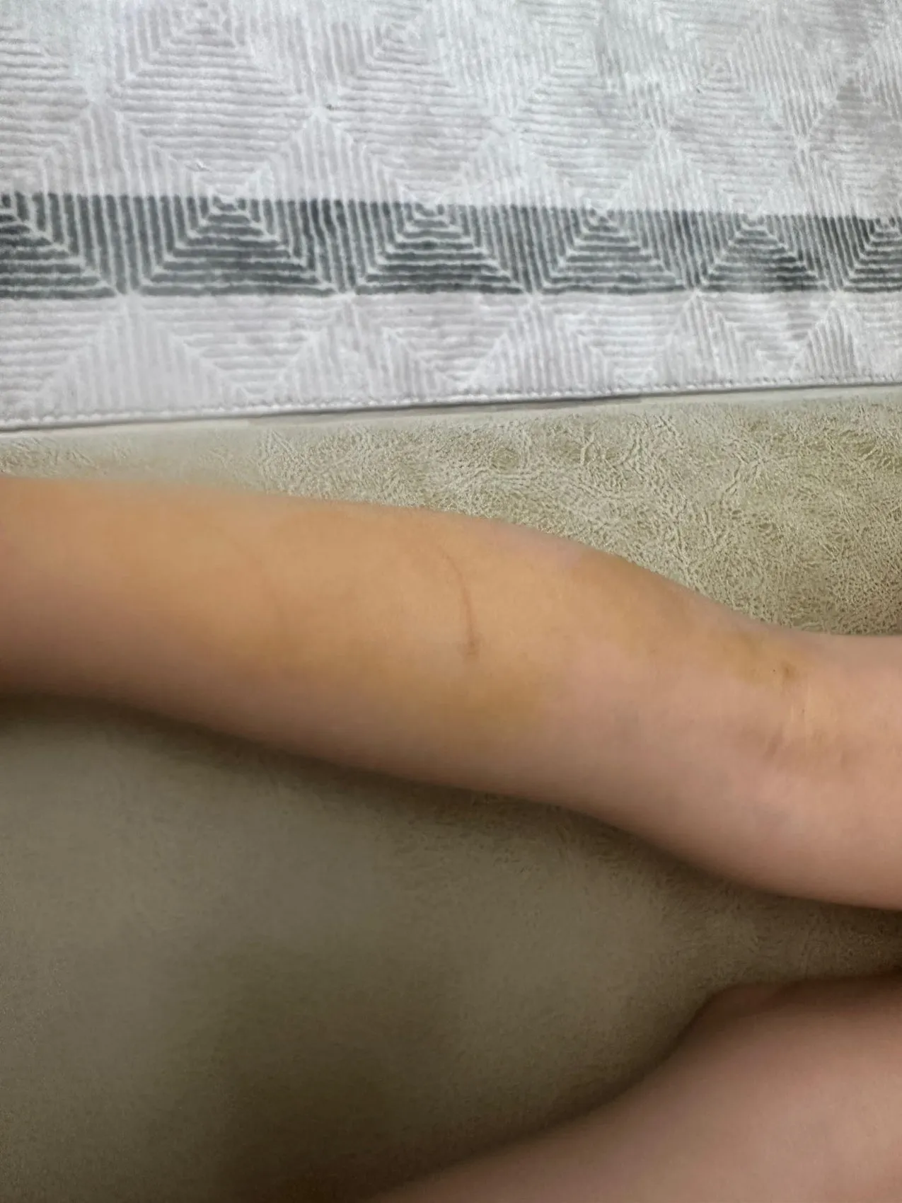 Şanlıurfa Halfeti'de küçük çocuk sokak köpeğinin saldırısı sonucu yaralandı
