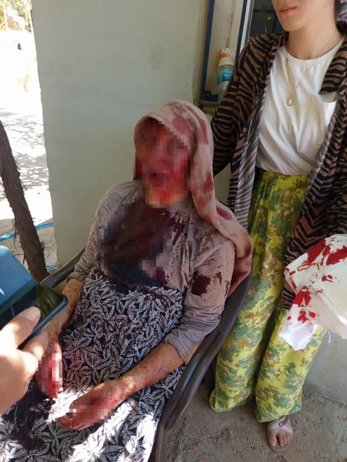 Şanlıurfa Bozova'da dehşet anları Oğlu 85 yaşındaki annesini sopayla dövdü