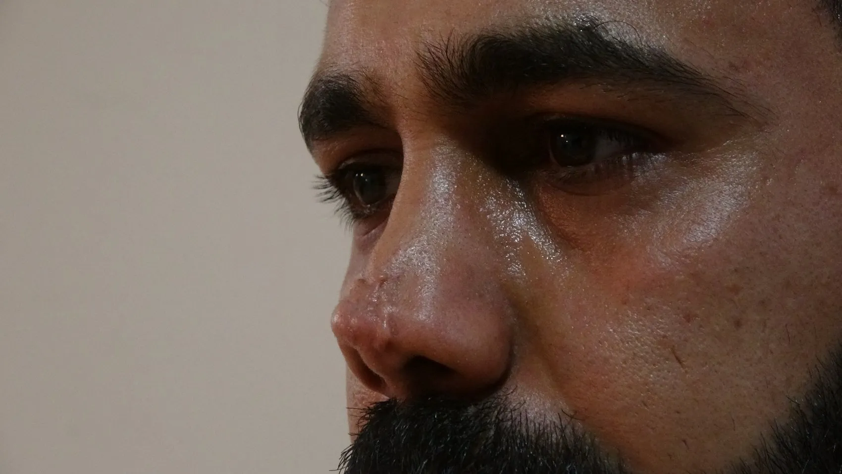 Estetik ameliyat sonrası burnunda oluşan iz için hastaneye dava açtı