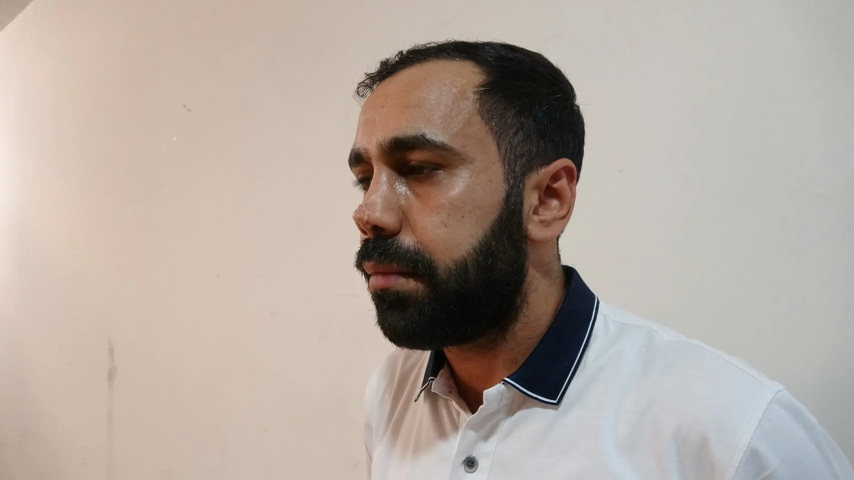Estetik ameliyat sonrası burnunda oluşan iz için hastaneye dava açtı