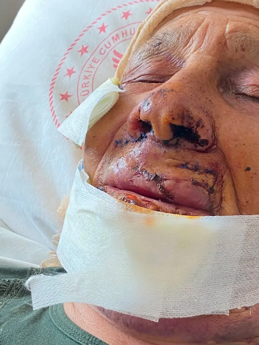 Şanlıurfa Bozova'da dehşet anları Oğlu 85 yaşındaki annesini sopayla dövdü