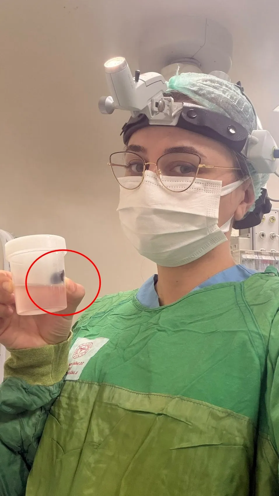 Siirt'te burun kanaması şikayetiyle gelen çocuğun boğazından canlı sülük çıktı